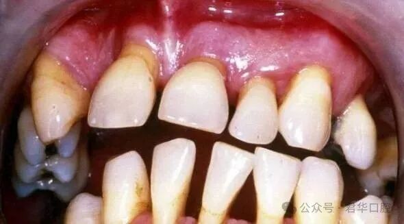 塞牙也是一种病-2.jpg