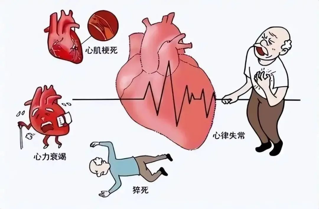 心力衰竭的诊断、治疗及相关指南解读