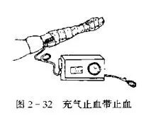 为什么要结扎血管止血技术_https://www.jmylbn.com_新闻资讯_第7张
