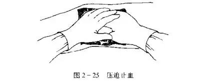为什么要结扎血管止血技术_https://www.jmylbn.com_新闻资讯_第1张