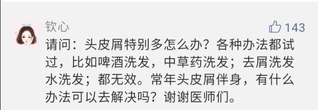 头皮屑多怎么办？治疗方法都写在这里了