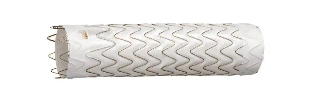 斑马导丝是治疗什么的「胸有乾坤」至简至易 行之有效—— Zone 0 TBE植入治疗弓部动脉瘤病例报道_https://www.jmylbn.com_新闻资讯_第29张