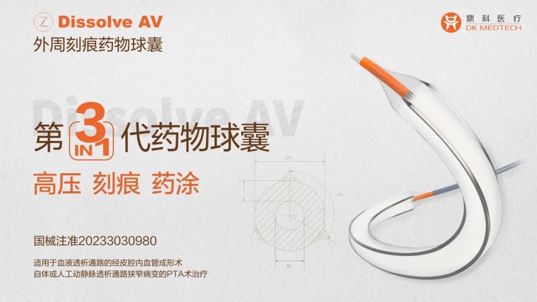 pta在医学上什么意思鼎例相助 ｜ 张和平教授团队：刻痕药涂球囊的应用体会_https://www.jmylbn.com_新闻资讯_第1张