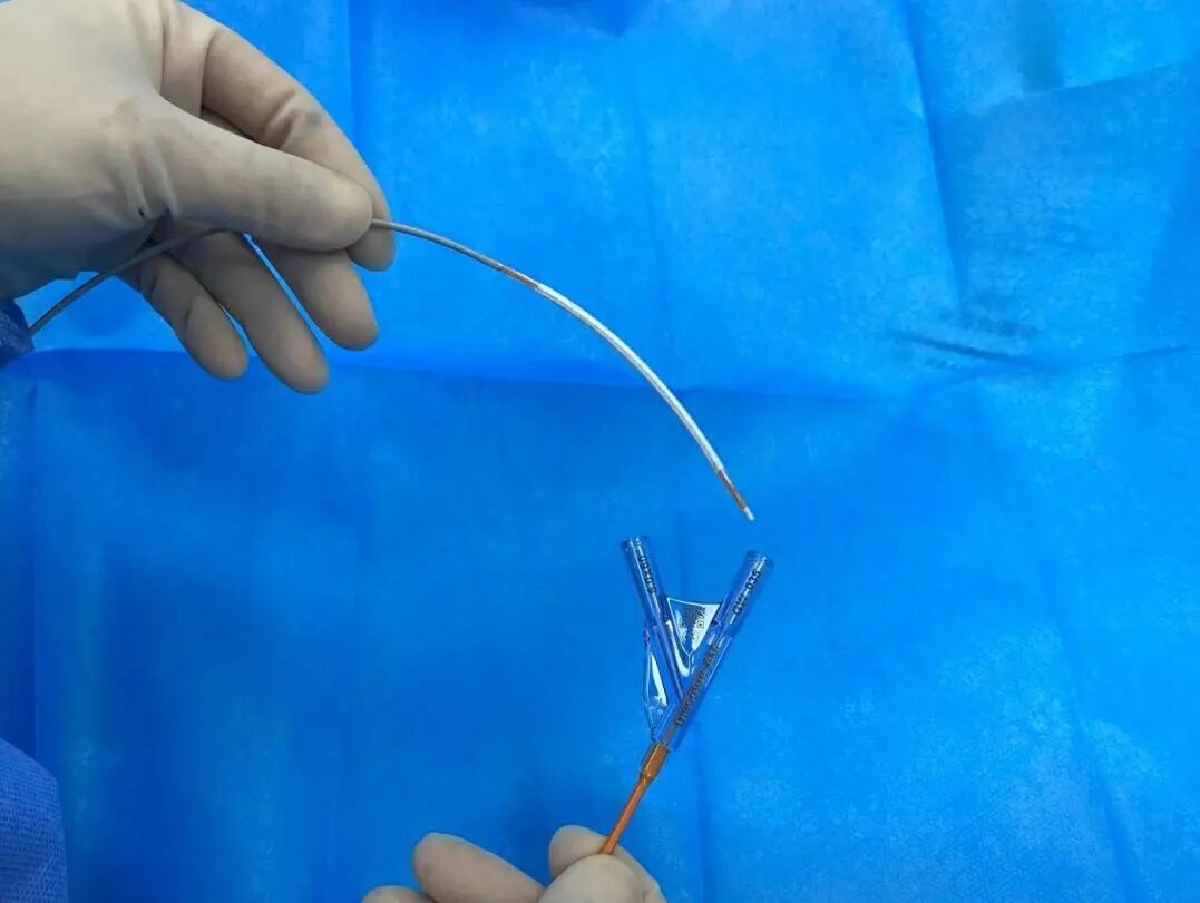 pta在医学上什么意思鼎例相助 ｜ 张和平教授团队：刻痕药涂球囊的应用体会_https://www.jmylbn.com_新闻资讯_第11张