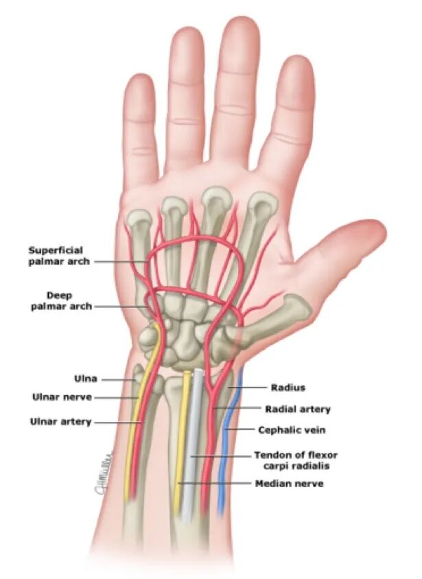动脉长鞘怎么置入桡胜一筹丨杨敏教授团队：应用Brite Tip Radianz长鞘经远桡动脉治疗肾动脉狭窄一例_https://www.jmylbn.com_新闻资讯_第31张