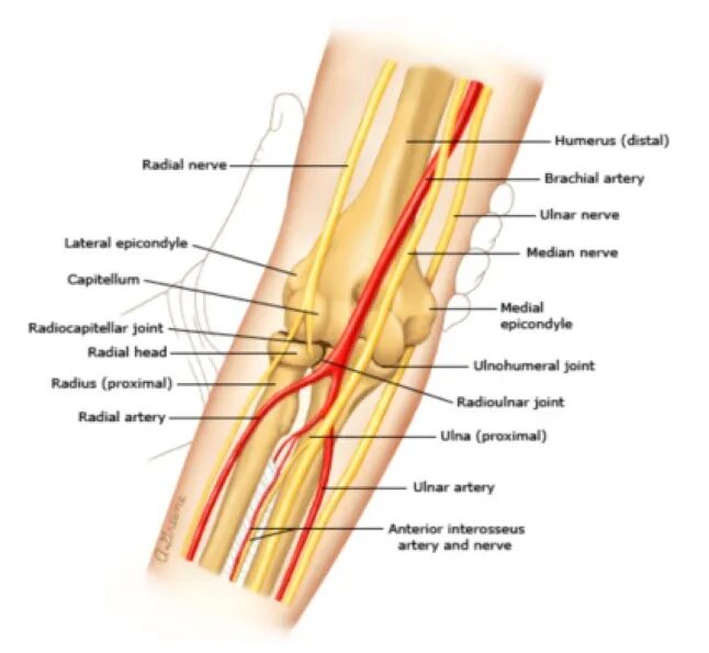 动脉长鞘怎么置入桡胜一筹丨杨敏教授团队：应用Brite Tip Radianz长鞘经远桡动脉治疗肾动脉狭窄一例_https://www.jmylbn.com_新闻资讯_第30张