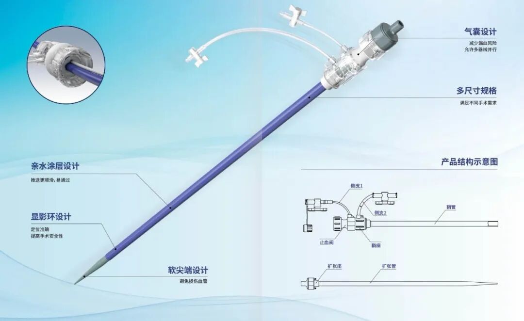 血管鞘组是什么器械百科丨Corpassing泊淮™ 导管鞘组_https://www.jmylbn.com_新闻资讯_第7张