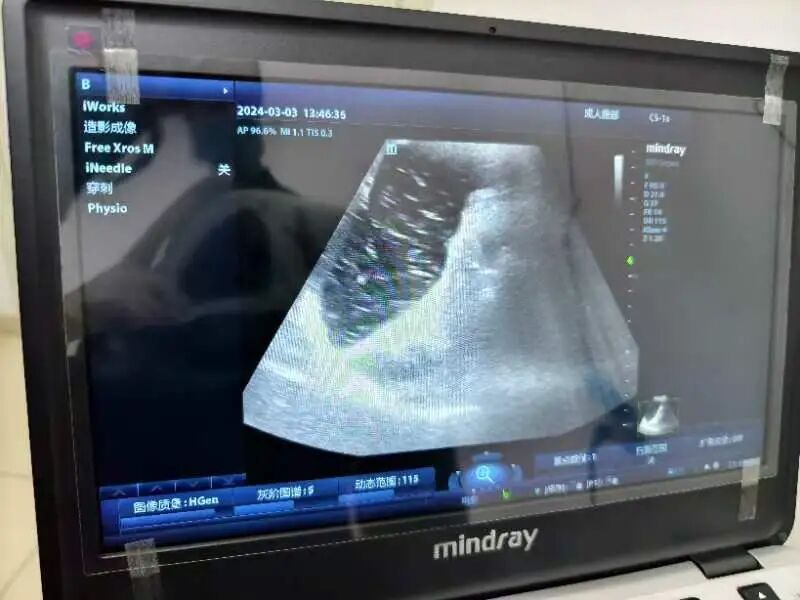 洗胃去什么科【红星科普】让超声引导下洗胃技术与传统盲洗胃说“拜拜”！_https://www.jmylbn.com_新闻资讯_第14张