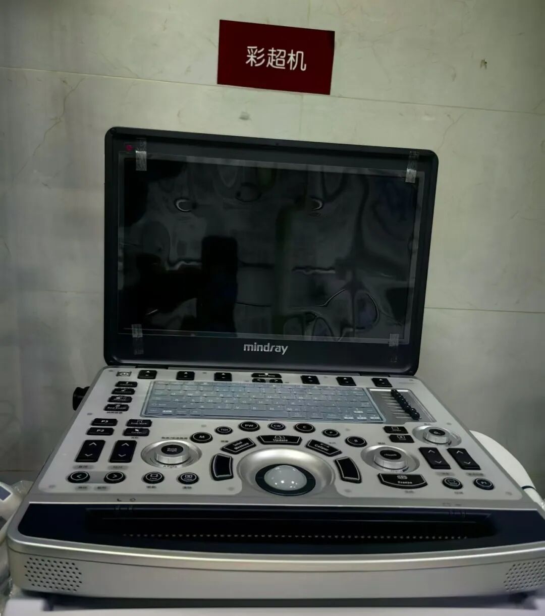 洗胃去什么科【红星科普】让超声引导下洗胃技术与传统盲洗胃说“拜拜”！_https://www.jmylbn.com_新闻资讯_第7张