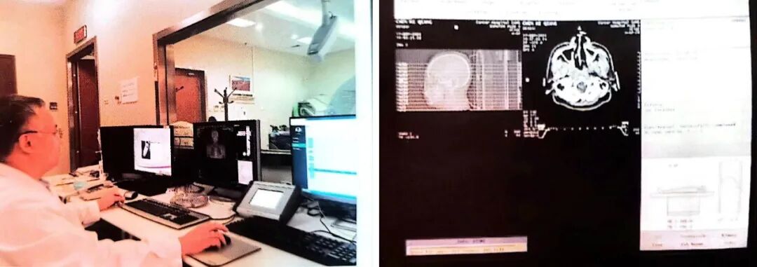 什么是定位放疗【健康科普】头颈肿瘤患者的放疗定位究竟是什么？_https://www.jmylbn.com_新闻资讯_第6张