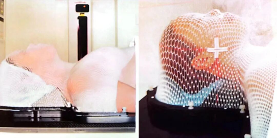 什么是定位放疗【健康科普】头颈肿瘤患者的放疗定位究竟是什么？_https://www.jmylbn.com_新闻资讯_第5张