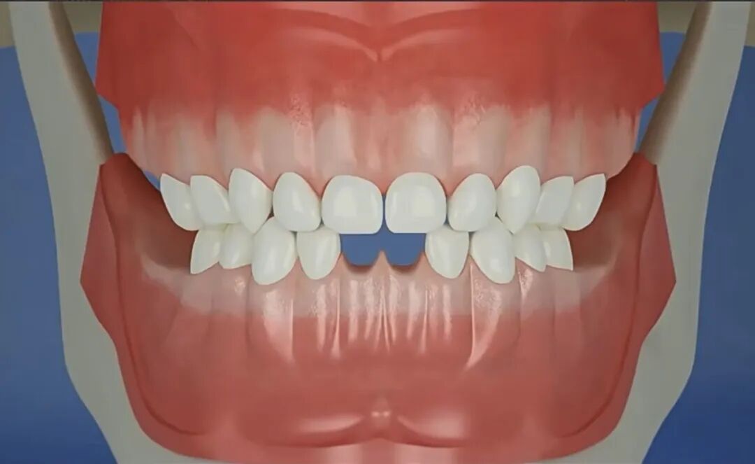 曲面断层片怎么看换牙与身高有关吗？关于孩子换牙的所有疑问一篇说清_https://www.jmylbn.com_新闻资讯_第12张