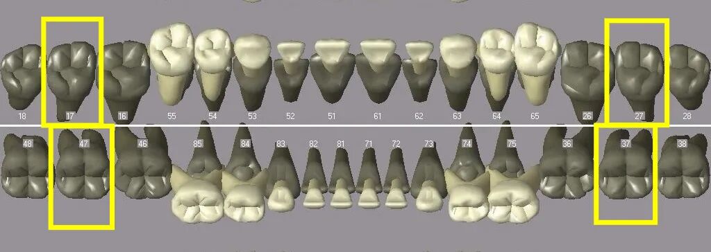 曲面断层片怎么看换牙与身高有关吗？关于孩子换牙的所有疑问一篇说清_https://www.jmylbn.com_新闻资讯_第9张