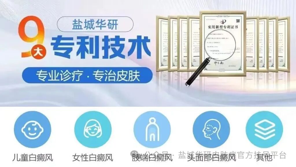 盐城华研皮肤医院哪家好头皮油腻、发红脱屑与掉发加剧的原因及对策