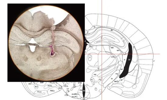 脑体互作研究—神经药效评价实验外包平台