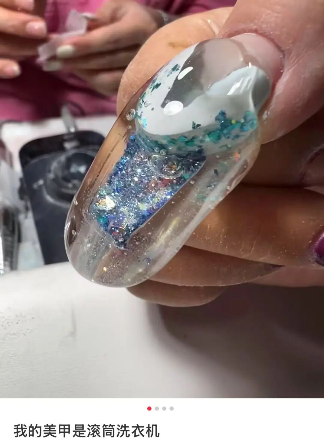 牙科光固化机是什么光患者齿科术后突发过敏，竟是美甲惹的祸？！_https://www.jmylbn.com_新闻资讯_第1张