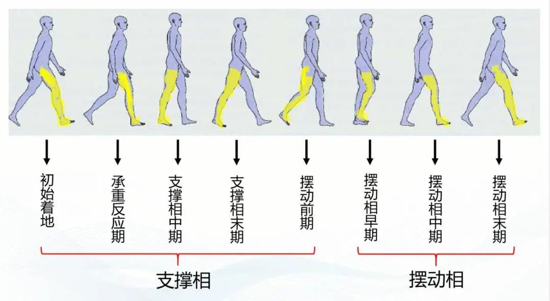 步态分析上曲线怎么解读康复科普｜常见异常步态的介绍及测试_https://www.jmylbn.com_新闻资讯_第7张