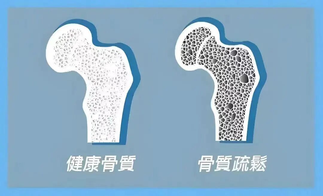 双能x骨密度检测仪为什么非得输入体重身高【健康管理中心】 双能X射线骨密度仪：精准守护骨骼健康，开启筛查新维度_https://www.jmylbn.com_新闻资讯_第3张