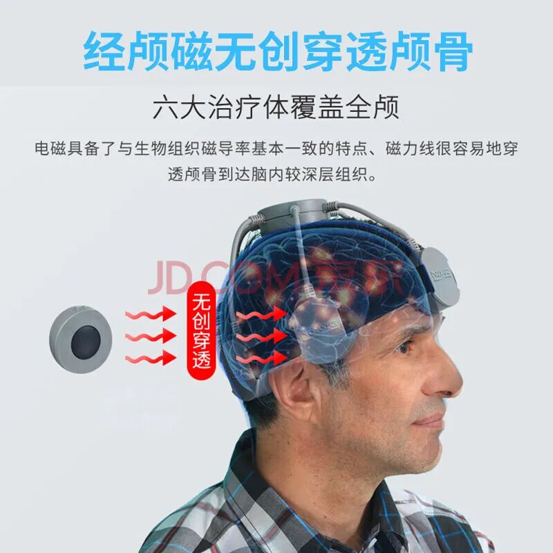 磁脉冲是什么什么是经颅磁刺激、重复经颅磁刺激？_https://www.jmylbn.com_新闻资讯_第4张