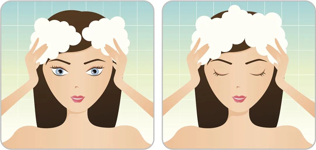 头部白癜风患者应该怎么洗头呢？要注意这3点！