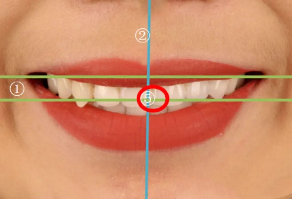 牙医看过来！正畸照片拍摄的正确姿势在这里