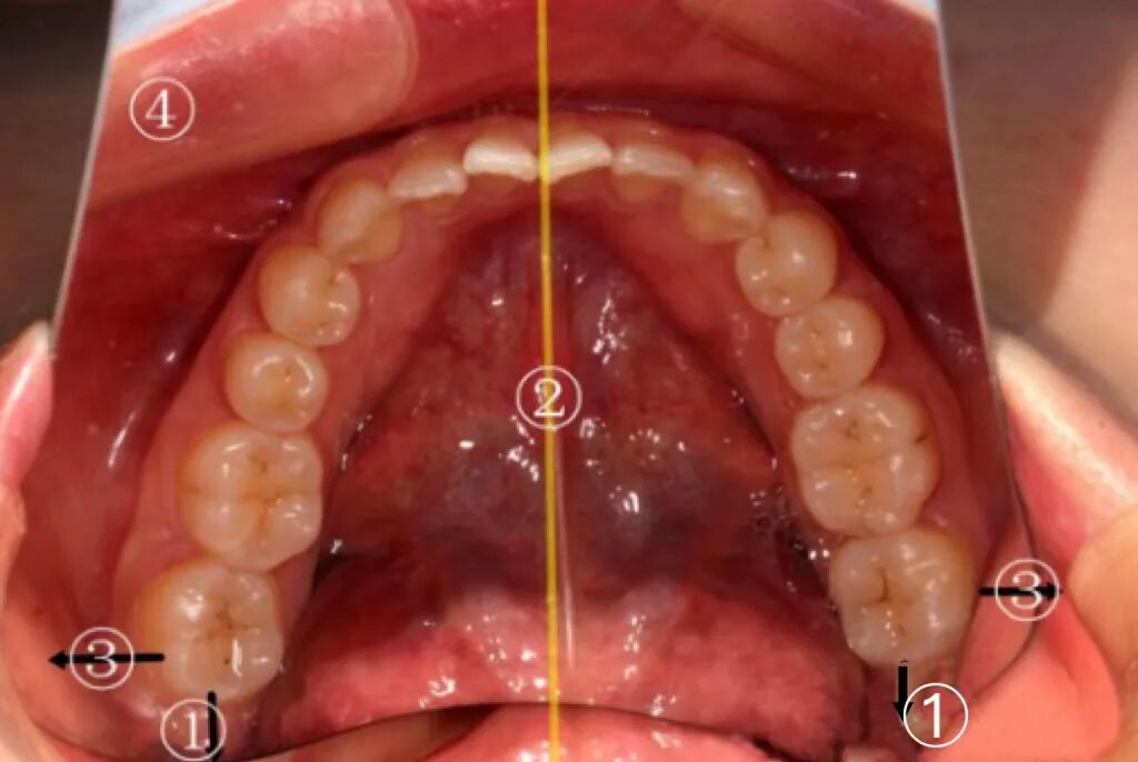 牙医看过来！正畸照片拍摄的正确姿势在这里