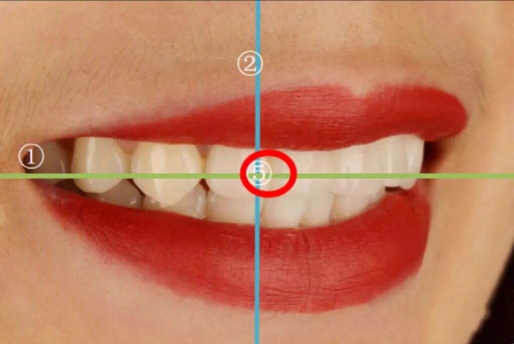 牙医看过来！正畸照片拍摄的正确姿势在这里