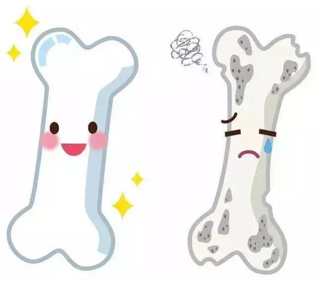 骨密度bmd是什么骨密度检查报告，你看懂了吗？_https://www.jmylbn.com_新闻资讯_第7张