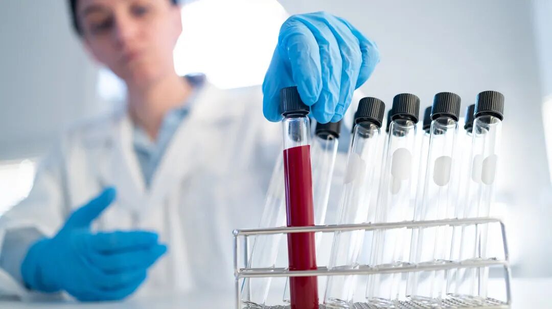 ivd外企怎么样又一重磅品种集采，5折拟中选，国产替代趋势明显_https://www.jmylbn.com_新闻资讯_第5张