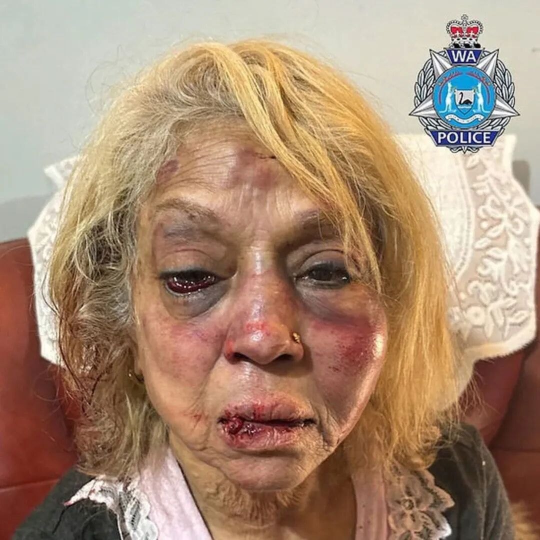 重磅！疫苗厂商首次承认罕见副作用，恐致残致命！面临天价赔偿（组图） - 2
