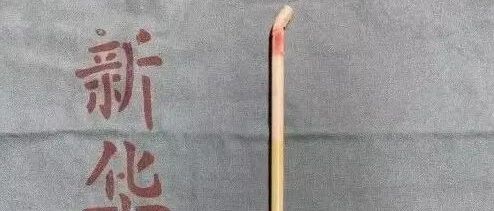 可怕！女孩摔倒撞上货架！一根铁棍坠下直插她的头颅…上海医生直接这样做…