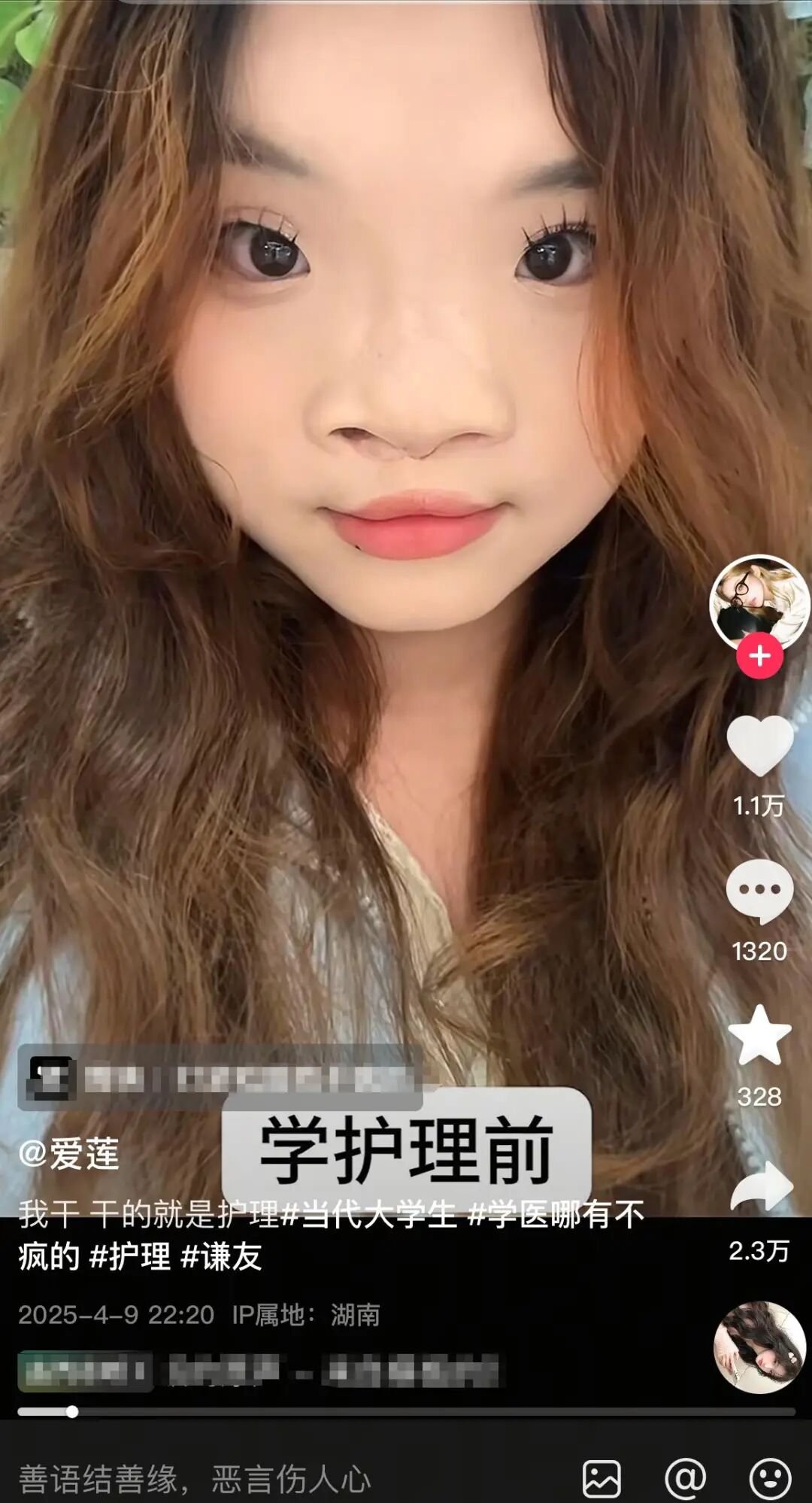 手术人工鼻是什么对话遭外貌攻击的“先天唇腭裂”女孩：做过三次手术，出身和样貌不是我们能决定的_https://www.jmylbn.com_新闻资讯_第3张