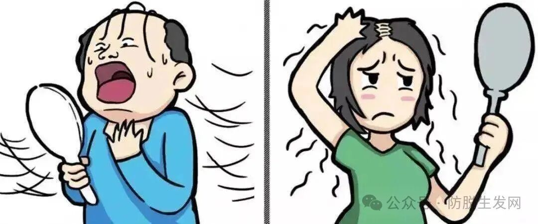 掉头发严重什么原因