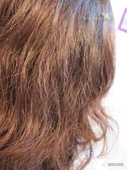 怎么改善头发毛躁干枯