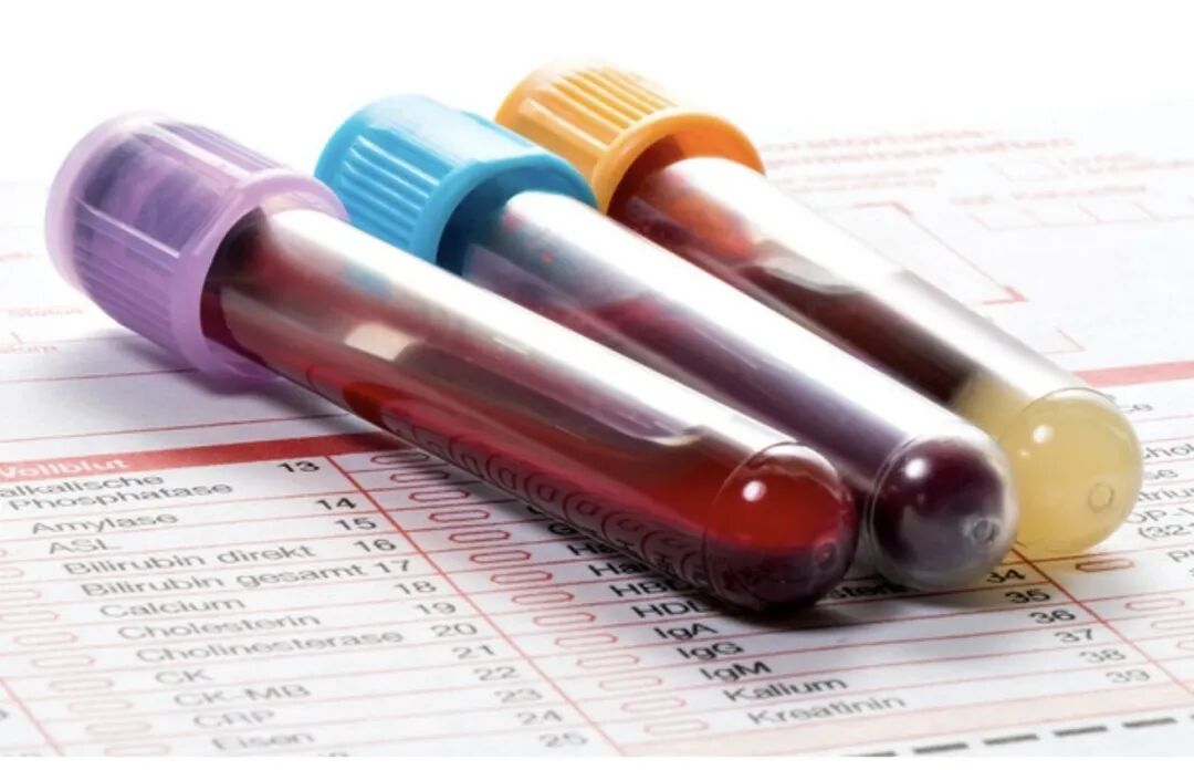 血流变是什么颜色的管【小装置 大学问】五颜六色的采血管到底有什么奥秘？快来看看！_https://www.jmylbn.com_新闻资讯_第2张