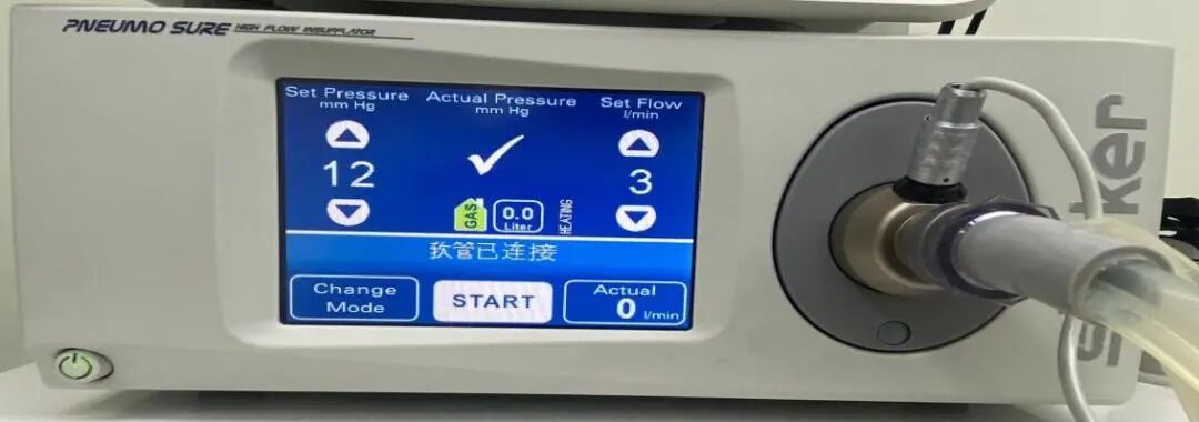 气腹管怎么接浅聊腹腔镜手术中CO2气腹管理_https://www.jmylbn.com_新闻资讯_第3张
