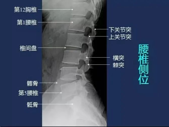 拍胃肠机怎么收费【医学影像科普】腰疼想拍片检查，您拍对了吗？_https://www.jmylbn.com_新闻资讯_第5张