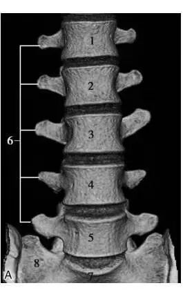 拍胃肠机怎么收费【医学影像科普】腰疼想拍片检查，您拍对了吗？_https://www.jmylbn.com_新闻资讯_第8张