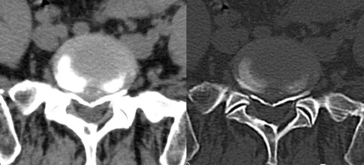 拍胃肠机怎么收费【医学影像科普】腰疼想拍片检查，您拍对了吗？_https://www.jmylbn.com_新闻资讯_第9张