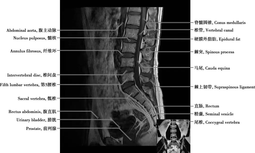 拍胃肠机怎么收费【医学影像科普】腰疼想拍片检查，您拍对了吗？_https://www.jmylbn.com_新闻资讯_第10张