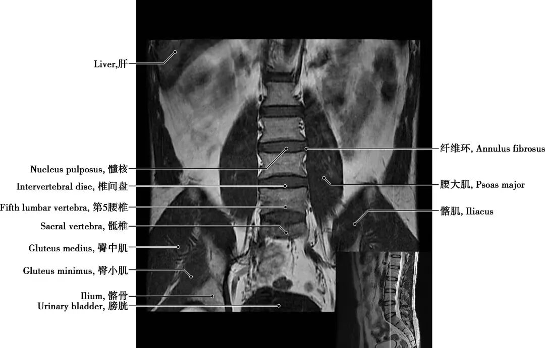 拍胃肠机怎么收费【医学影像科普】腰疼想拍片检查，您拍对了吗？_https://www.jmylbn.com_新闻资讯_第11张
