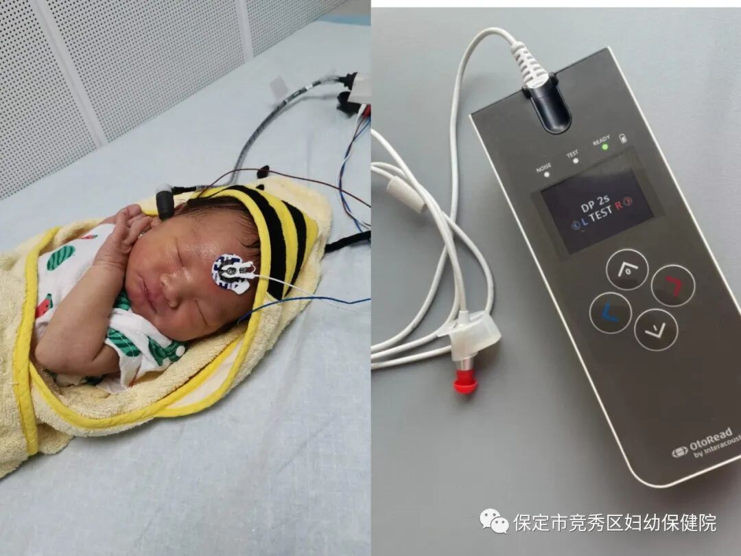 中耳筛查怎么做【科室动态】听力筛查结果解读_https://www.jmylbn.com_新闻资讯_第1张