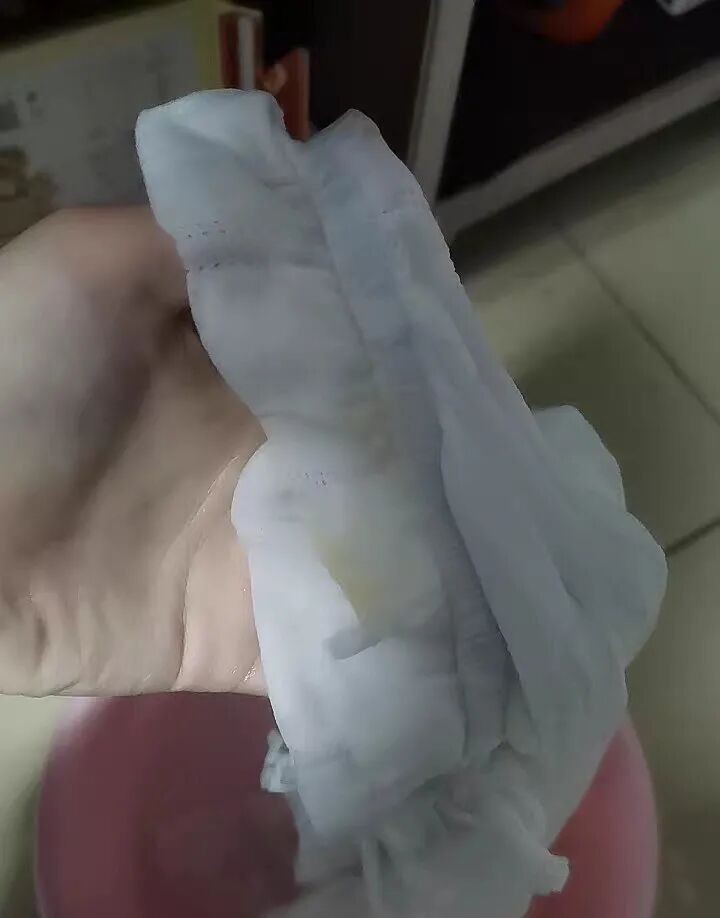 用什么消毒床单被被消毒液腐蚀褪色的衣服不要扔,只需一招就能满血复活,简单易操作!_新闻资讯_第5张_活检穿刺产品网 用什么消毒床单被被消毒液腐蚀褪色的衣服不要扔,只需一招就能满血复活,简单易操作!_https://www.jmylbn.com_新闻资讯_第5张