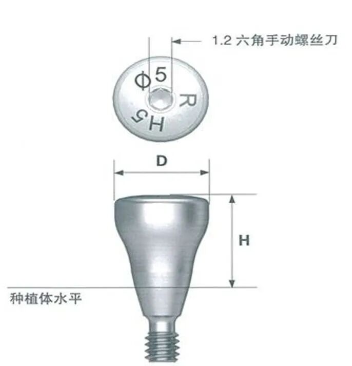 愈合机台怎么识别型号愈合基台的定义、分类、特点和临床选择，一文详解_https://www.jmylbn.com_新闻资讯_第23张