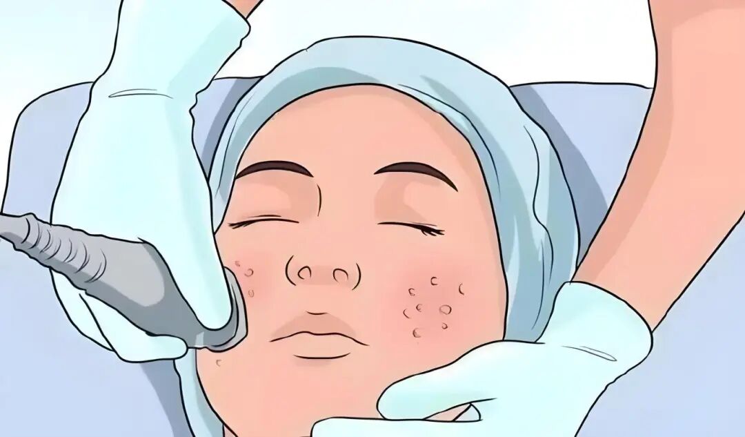 什么是光电治疗光电治疗项目术后要注意这些！_https://www.jmylbn.com_新闻资讯_第2张