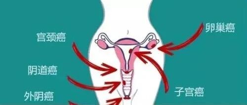 这些只挑女性下手的癌症，怎样才能轻松避开