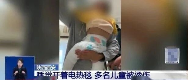 冬天取暖须防低温烫伤