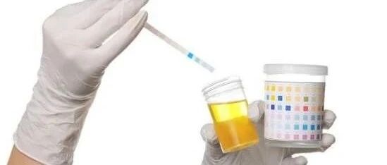 血糖不高尿糖高 问题究竟出在哪