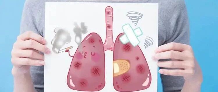 肺癌患者“续命”五要点