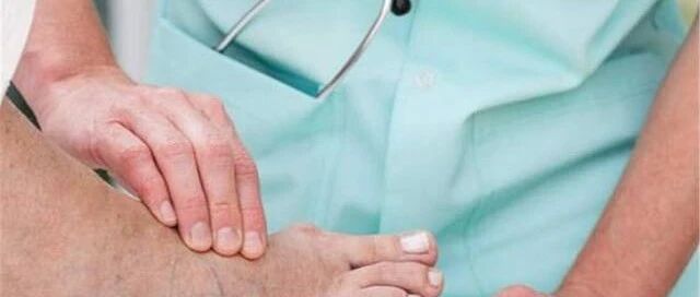 脚趾变形了，为什么医生让我验血？